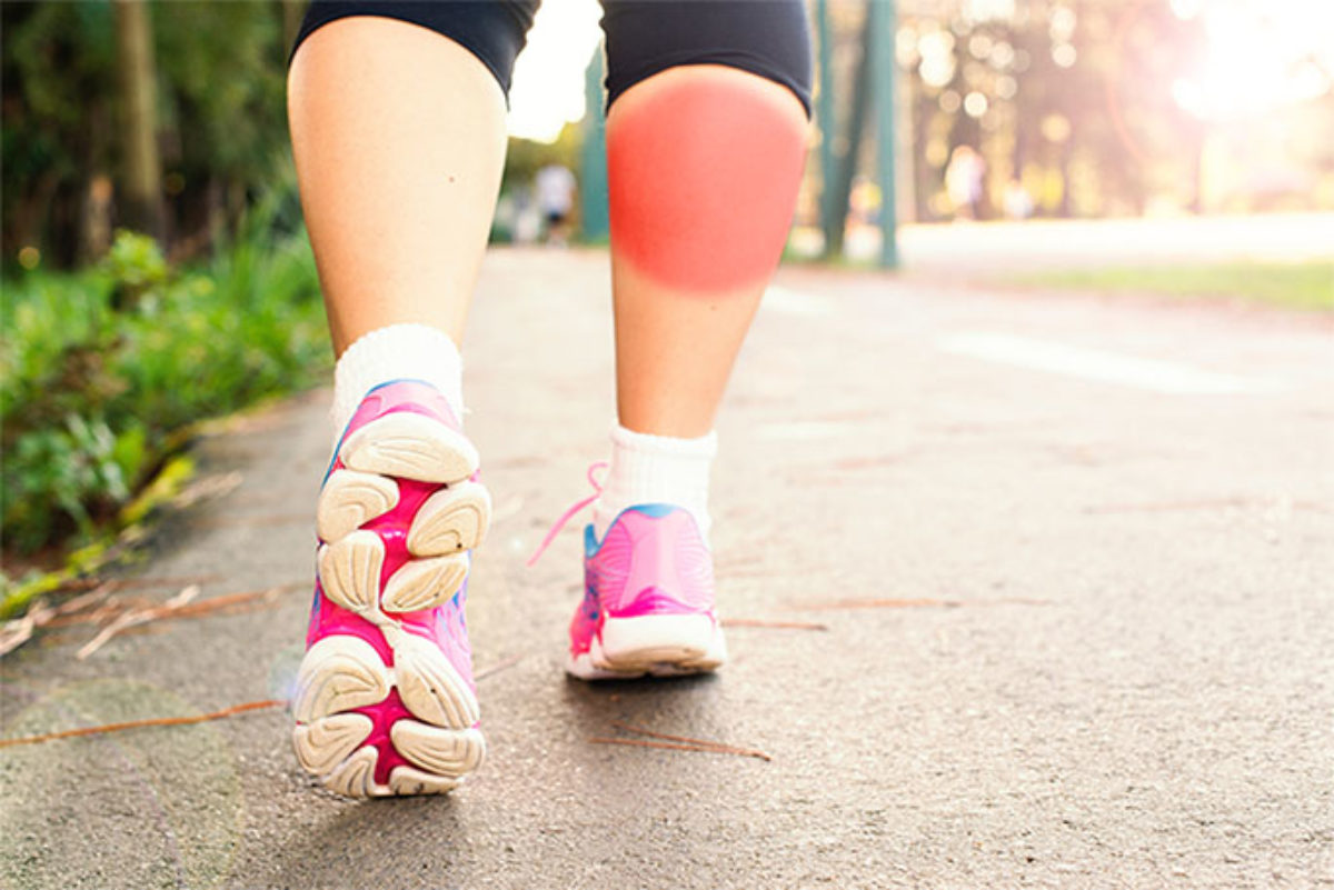 Do Varicose Veins Burn Manometcurrent