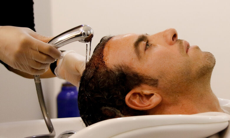 FUE Hair Transplant