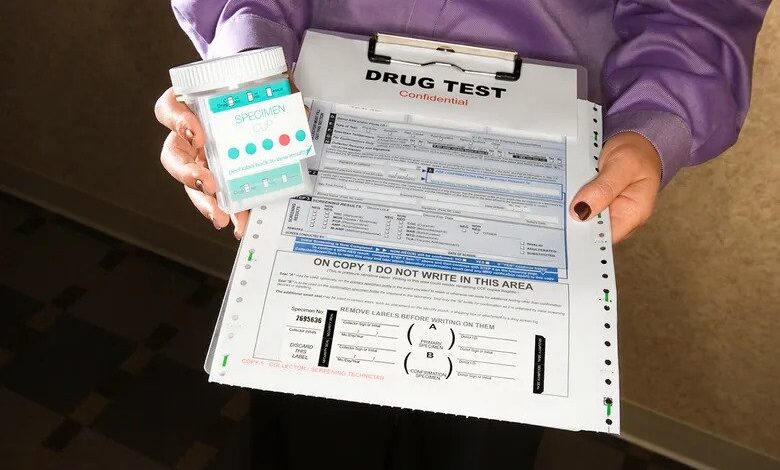 Pre-Employment Drug Testing