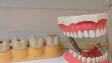 Denture Implants