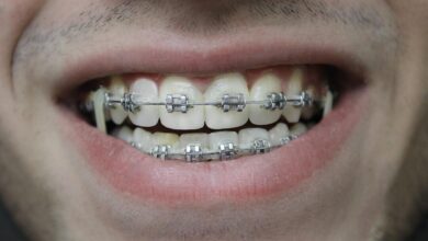 Orthodontic Services