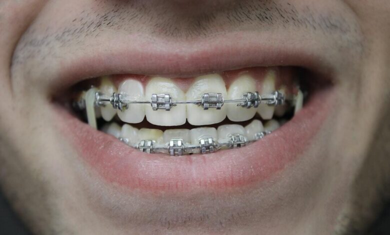 Orthodontic Services