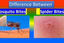 Mosquito vs. Spider Bites