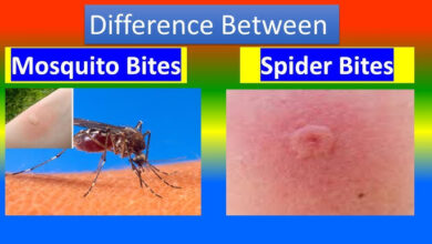 Mosquito vs. Spider Bites