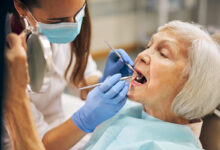 Dental Implants