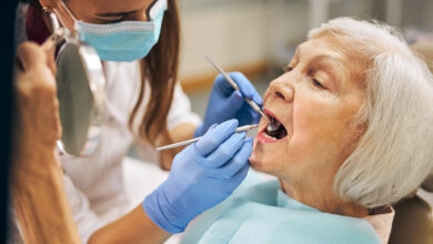 Dental Implants