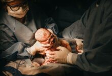 Brain Injuries at Birth