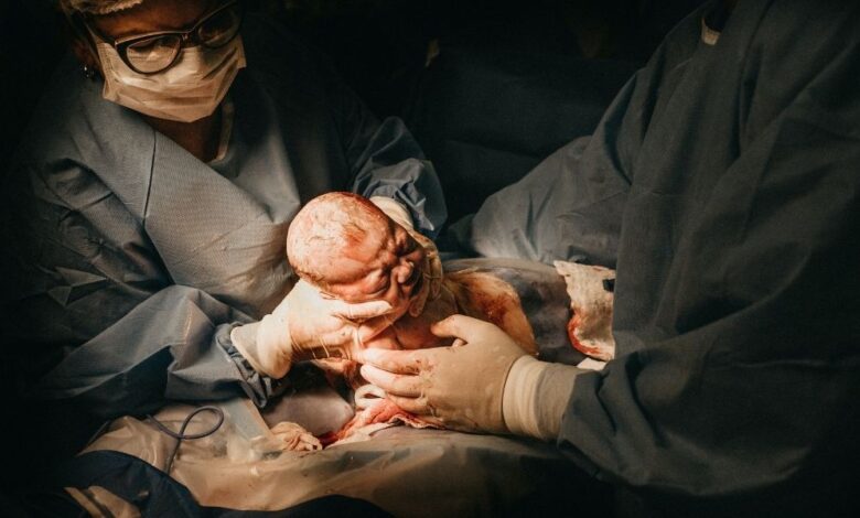 Brain Injuries at Birth